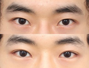 after & before 1