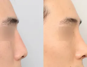 after & before 3
