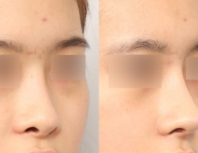 after & before 5