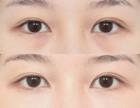 after & before 6